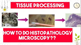 Tissue Processing | How to do Histopathology Light Microscopy? | 9 Steps of Tissue Processing |