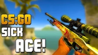 CS:GO - SICK AWP ACE + COLLATERAL