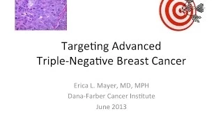 Targeting Advanced Triple-Negative Breast Cancer | Dana-Farber Cancer Institute