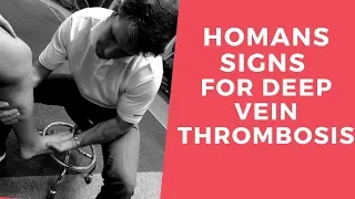 Homans Sign for Deep Vein Thrombosis