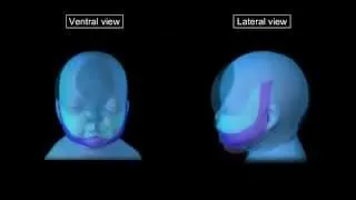 Development of face and palate