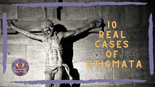 Top 10 Cases of Stigmata