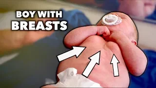 HELP! (My Newborn Son Has Breasts) | Dr  Paul