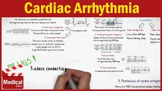 Pharmacology - Cardiac Arrhythmia and Antiarrhythmic Drugs FROM A TO Z