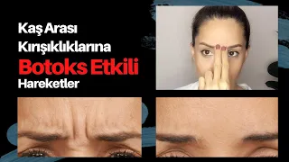 Kaş Arası Kırışıklıklara Botoks Yaptırmadan Veda Edin | Frown Lines Face Yoga