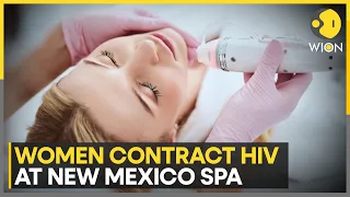 3 women contract HIV after getting ‘vampire facial’ at New Mexico spa | WION News