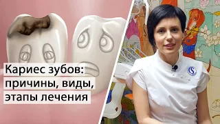 Кариес зубов - причины, виды, этапы лечения | Терапевтическая стоматология