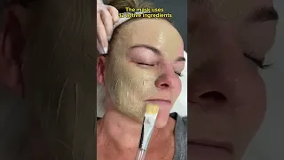 Cosmelan de-pigmentation peel | Dr. Medispa