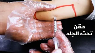 طريقة اعطاء حقن تحت الجلد بطريقة سهلة(انسولين_هيبارين_كليكسان)_How to give a subcutaneous injection