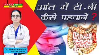 आंत की टी बी कैसे पहचानें ? || Abdominal Tuberculosis