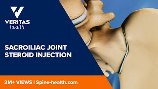 Sacroiliac Joint Steroid Injection