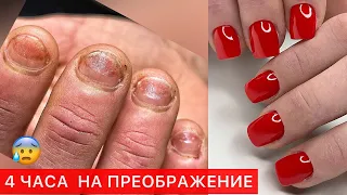 ЗАРОСШАЯ КУТИКУЛА И НАРАЩИВАНИЕ ГРЫЗУНЧИКУ😰СЛОЖНЫЙ МАНИКЮР