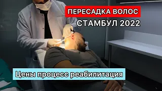 ПЕРЕСАДКА ВОЛОС СТАМБУЛ 2022год. ЦЕНЫ, КЛИНИКА, ПРОЦЕСС ВОССТАНОВЛЕНИЕ