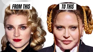 Madonna: Plastic Surgery - Lorry Hill