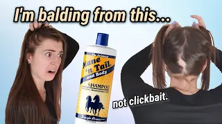 Mane 'n Tail made my hair fall out **wish this was clickbait**