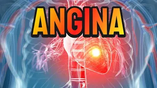 Angina (updated 2023) - CRASH! Medical Review Series