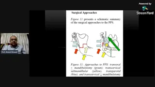 Trans-cervical Approach to Parapharyngeal Space Tumors- Prof.Ahmed Mosaad