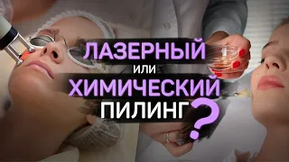 Лазерный или химический пилинг? Что выбрать?