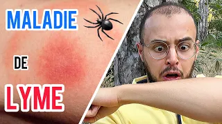 PIQÛRES DE TIQUES, MALADIE DE LYME : les bases à connaître !🕷