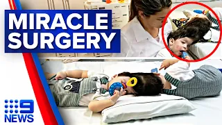 Conjoined twins successfully surgically separated | 9 News Australia