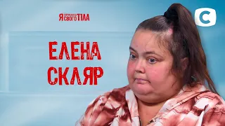 Елена Скляр страдает от себорейной пузырчатки – Я стесняюсь своего тела 2020