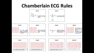 ECG course: Chamberlain ECG rules, Dr. Sherif Altoukhy