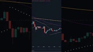 PARABOLIC SAR 5MIN & 15 MIN SCALPING STRATEGY EXPLAINED BIG PROFITS