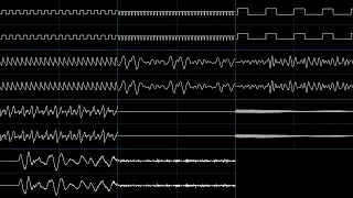 Sonic Advance 2 - Knuckles' Boss (oscilloscope view)