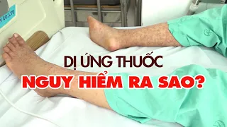 Dị ứng thuốc nguy hiểm ra sao?