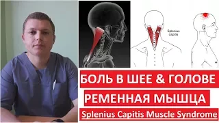 Ременная мышца | Как лечить боль в шее и голове | Splenius Capitis Muscle Syndrome
