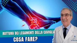 Rottura dei legamenti della caviglia cosa fare? | Lesione legamenti e Artrosi | Dott. Andrea Scala