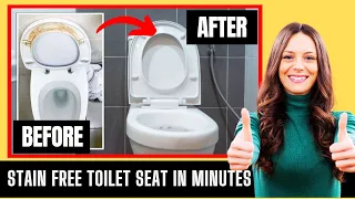 Magical Ways for Cleaning Yellow Stains on a Toilet Seat Instantly