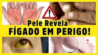 15 SINAIS NA PELE QUE REVELAM PROBLEMAS NO FÍGADO - com Dr Alain Dutra