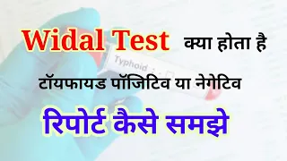 Widal test report reading in hindi | Widal test positive report | Widal Test in hindi