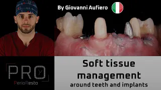 SOFT TISSUE MANAGEMENT AROUND TEETH AND IMPLANTES - Giovanni Aufiero