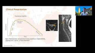 Diagnosis of Multiple Sclerosis