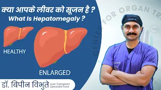क्या आपके लीवर में सूजन है ? Do You Have Swelling in Your Liver ? Hepatomegaly?  - Dr. Bipin Vibhute