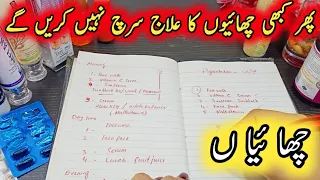 How To Remove Pigmentation,Dark Spots, Freckles,Melasma, Acne & Anemia In Urdu Hindi