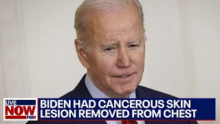 President Biden had cancerous skin lesion removed from chest, White House says | LiveNOW from FOX