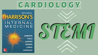 ST Elevation MI | Clinical Features | Diagnosis | Treatment