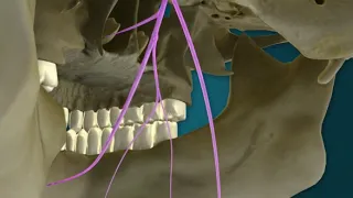 Part 11 of 14 CN IX - Glossopharyngeal Nerve pathway(s) narrated by Dr. Carmine Clemente
