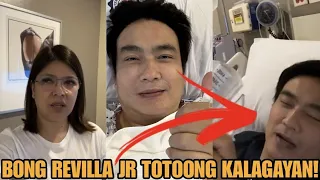 Senator Bong Revilla Jr Nag Undergo Ng EMERGENCY LAP-CHOLE PROCEDURE dahil Sa Kinain!Lani Revilla