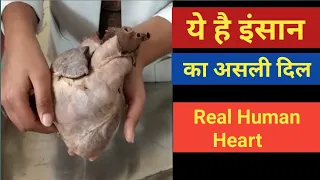 Real Human Heart | Explained by MBBS Students