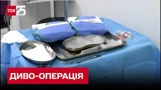 Диво-операція: хірурги Інституту Шалімова видалили пухлину поза тілом пацієнтки