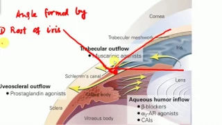 OPHTHALMOLOGY GLAUCOMA PART 2 Congenital Glaucoma BASICS