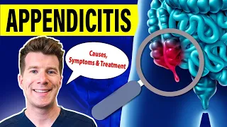 Doctor explains APPENDICITIS | Causes, symptoms and treatment