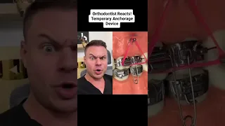 Orthodontist Reacts! BRACES JAW SCREW