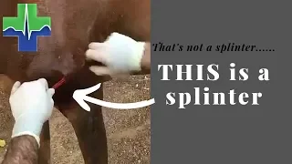 That's not a splinter.........THIS is a splinter!