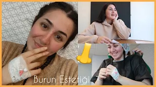 BURUN ESTETİĞİ OLUYORUM | Ameliyat Öncesi Süreç, Hazırlık ,Dikkat Edilmesi Gerekenler ,Fiyat? PART 1