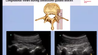 Pain Medicine - Lumbar Medial Branch, Facet Joint and Nerve Root Blocks